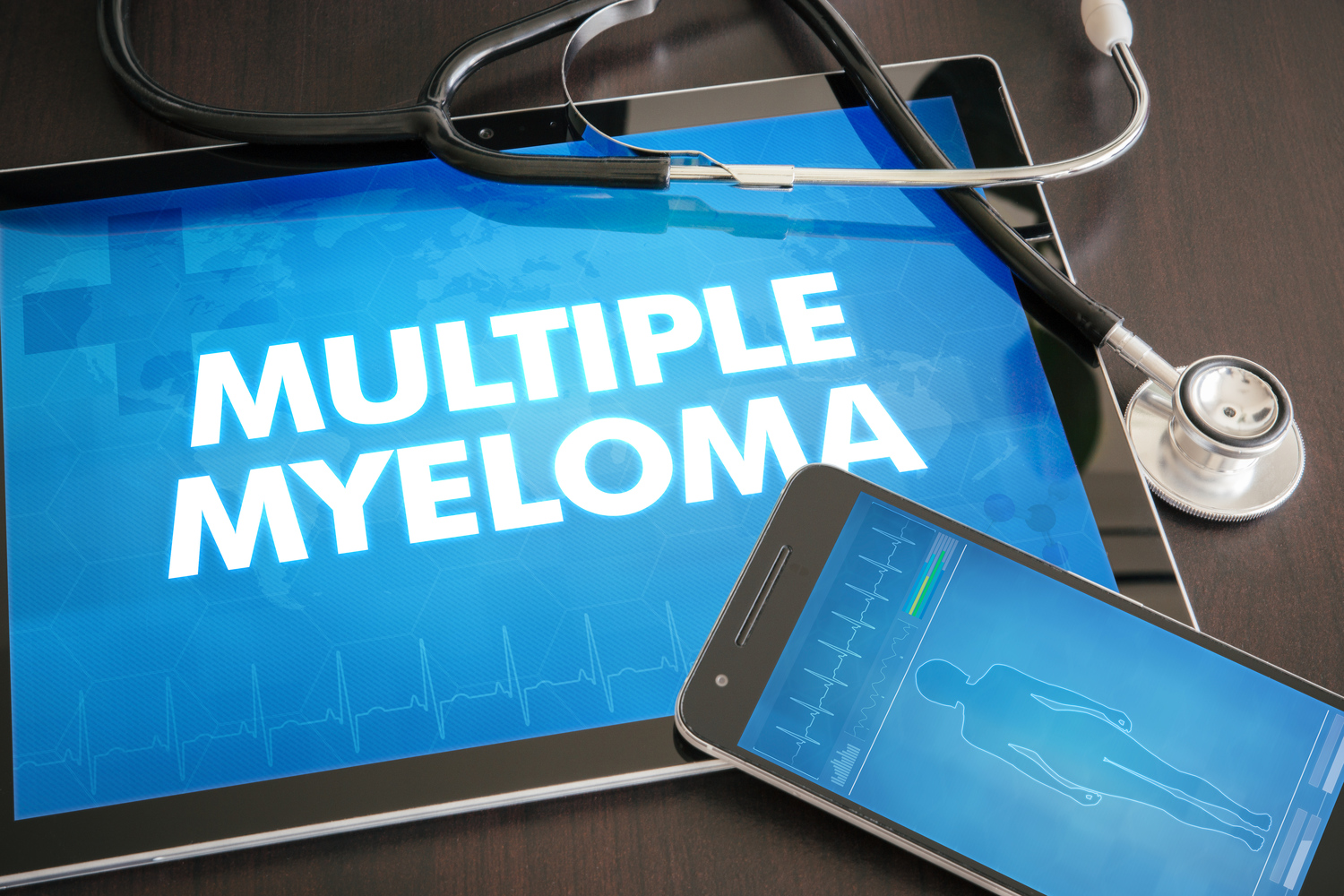 Multiple myeloma – diagnosis and treatment