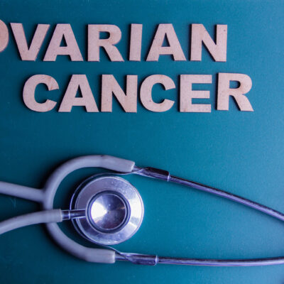 Symptoms, causes, and prevention of ovarian cancer