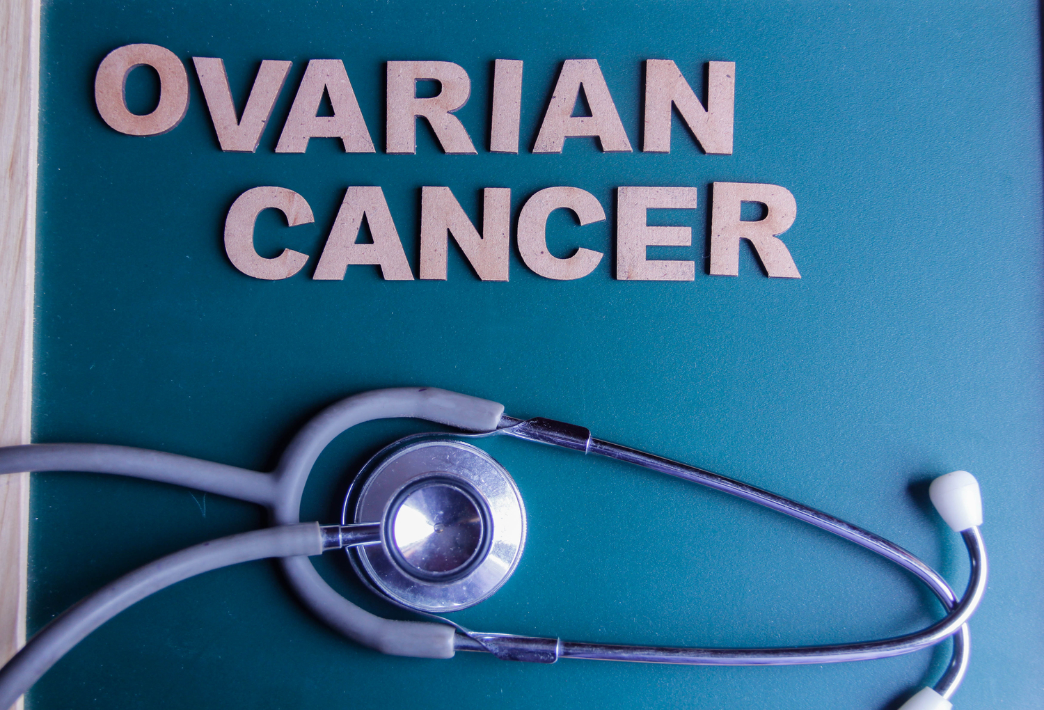 Symptoms, causes, and prevention of ovarian cancer