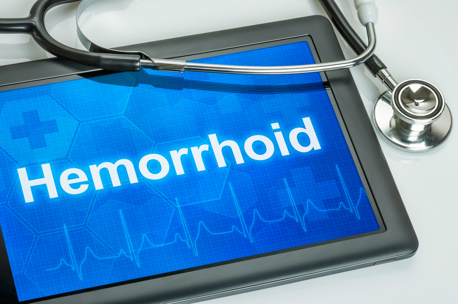 5 Ways to Prevent Hemorrhoids